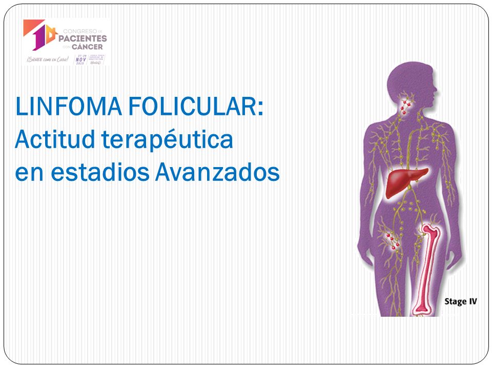 Folicular linfoma que un es